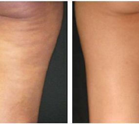 Massagem Corporal photo 2